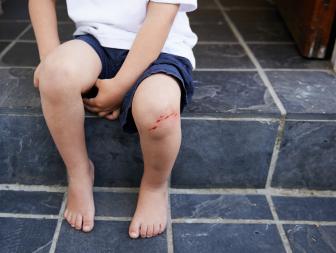 A young boy sitting on a step with a cut on his knee - cropped